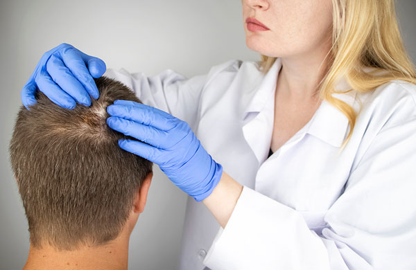 Cómo se llama el especialista que trata la caída del cabello